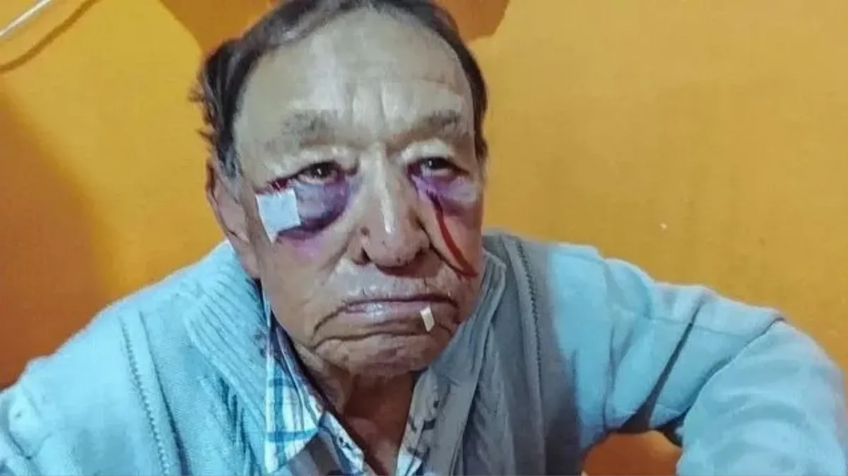 Un hombre habría resultado lesionado tras un episodio de violencia en Domínguez Un hombre habría resultado lesionado tras un episodio de violencia en Domínguez